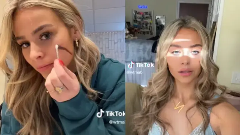 El regulador italiano obliga a TikTok a eliminar los vídeos de la «cicatriz francesa»